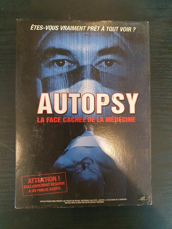 DVD : autopsy 1 Aubvillers (80)