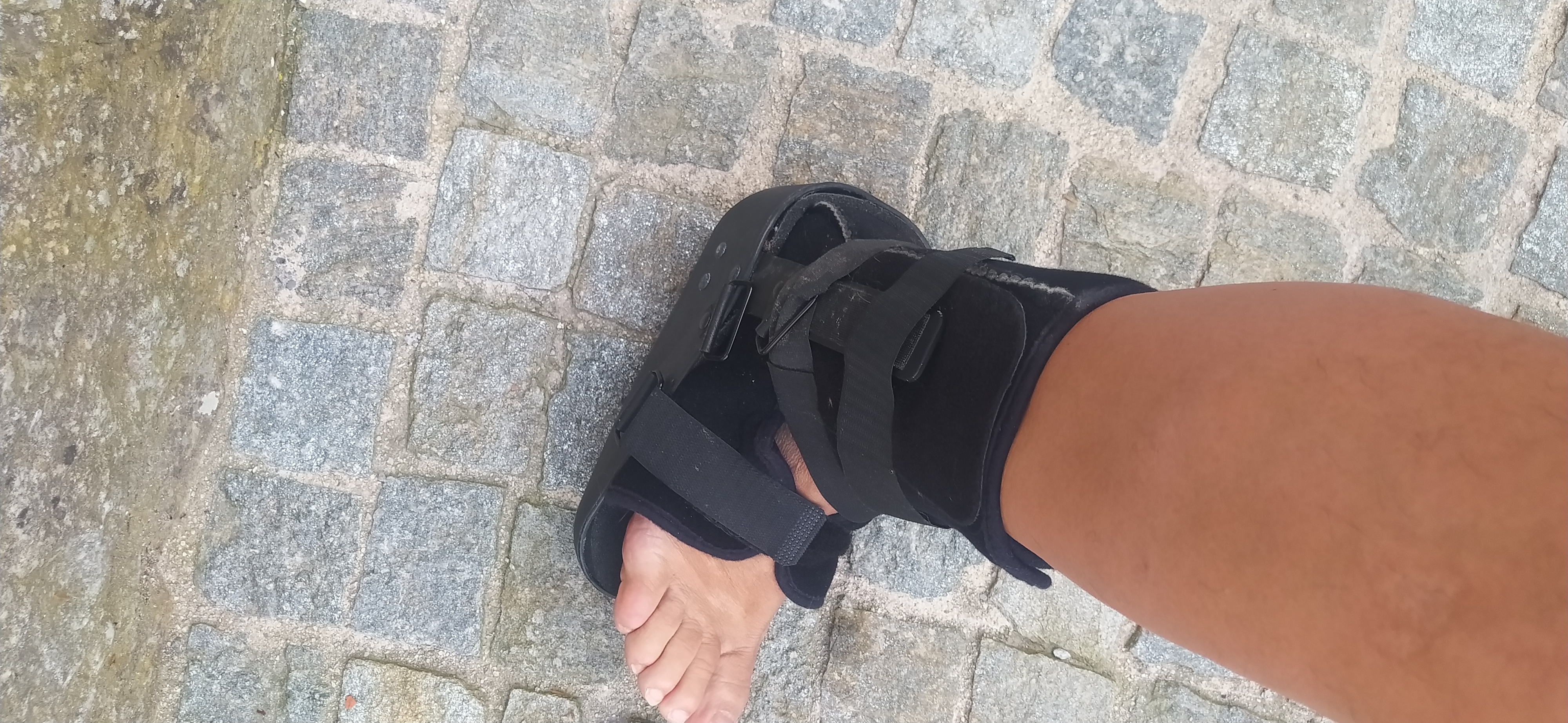 CHAUSSURE Orthop�dique OU  ATTELLE 10 Gilette (06)