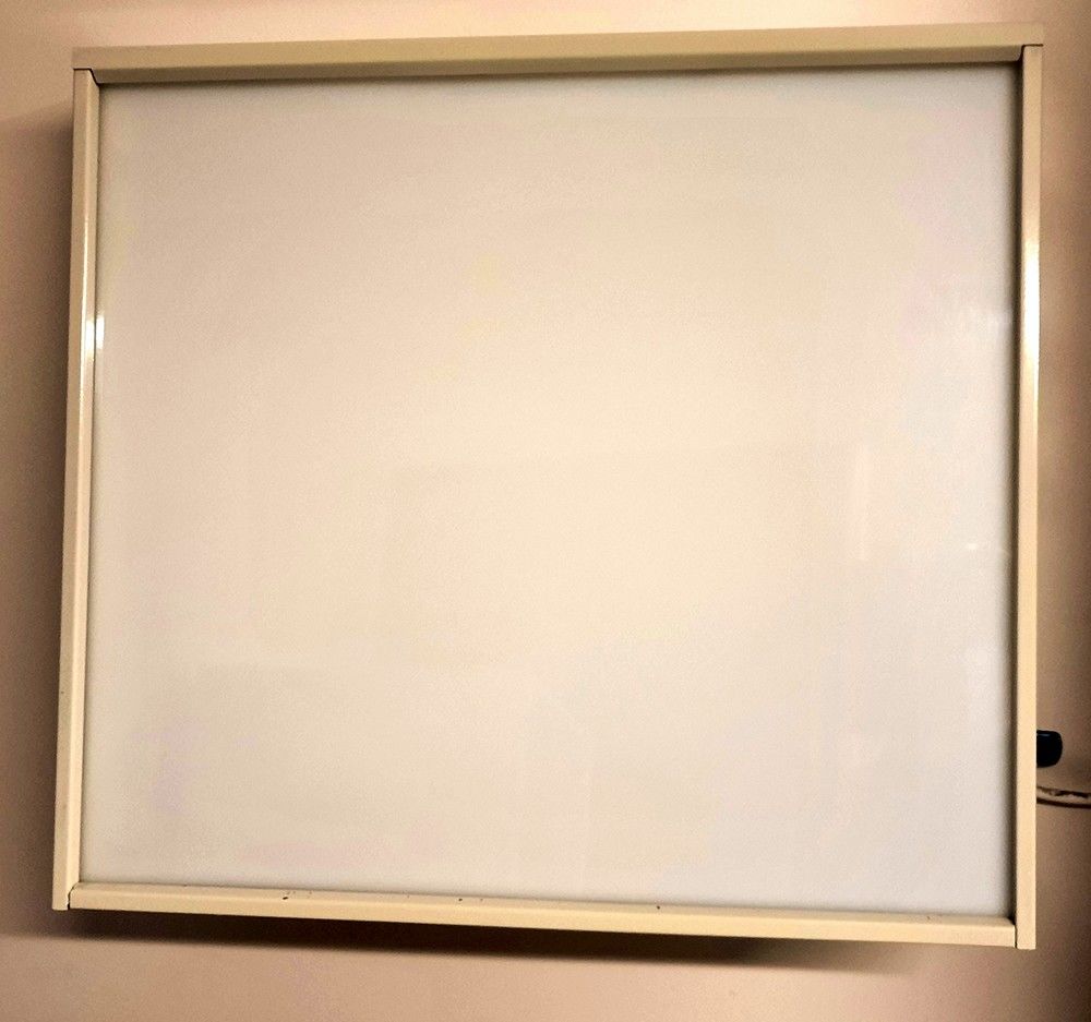 N�gatoscope vintage 50 Hergnies (59)