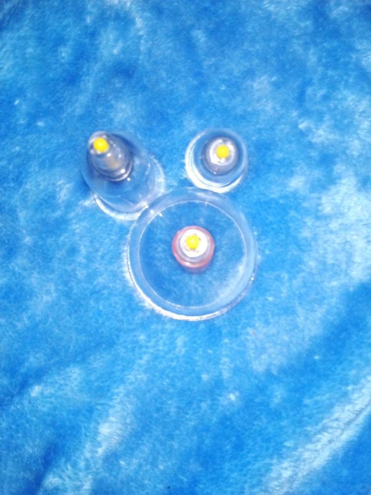 ventouse 12 Saint-Denis (97)