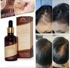 je vous propose un produits anti-chute  de cheveux,100% bio. 1 Boulay-Moselle (57)