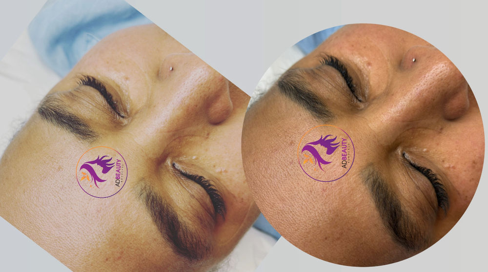 Coiffure - Manucure - gel -LaceWig - Beaut&eacute; des cils- topper 0 33000 Bordeaux