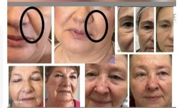 Soin du visage Gratuit pour les 100 Premiers Inscrits 0 75020 Paris