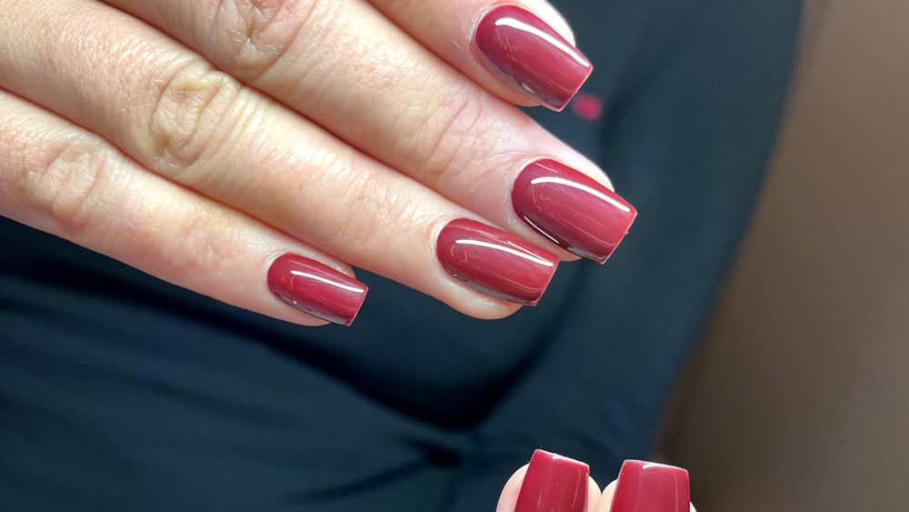 Proth&eacute;siste Ongulaire sur Peyriac-Minervois 0 11160 Peyriac-minervois