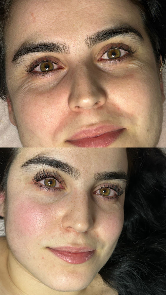 Prestations esth&eacute;tiques 0 13004 Marseille