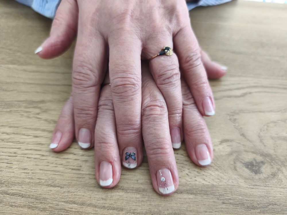 Proth&eacute;siste ongulaire 0 37270 V�retz